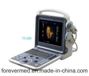 Diagnostic System Full Digital Trolley Color Doppler Ultrasound Scanner (YJ-U60)