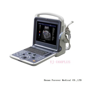 Adcance Technology Hospital Diagnostic Instrument Ultrasound Machine